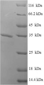 SDS-PAGE