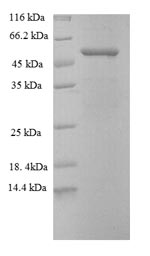 SDS-PAGE