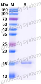 Валидация SDS-PAGE - AntibodySystem RHE14801