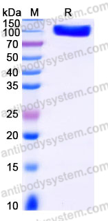 AHJ40402, SDS-PAGE