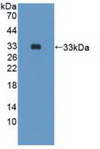 41913
