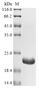 SDS-PAGE