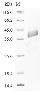 SDS-PAGE