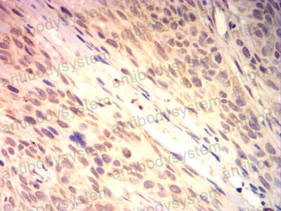 Валидация AntibodySystem RHG13212