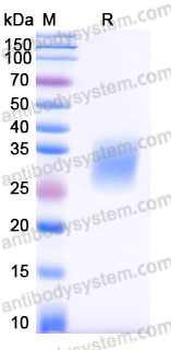 EHJ53504, SDS-PAGE
