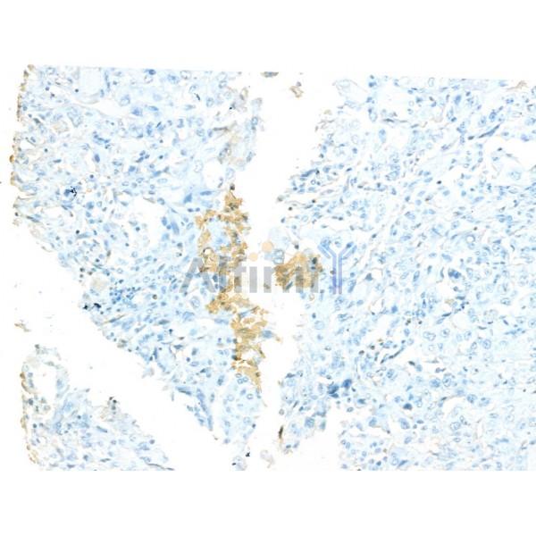 Валидация Affinity DF13333 - 8516