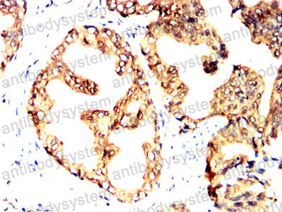 Валидация AntibodySystem RHJ44003