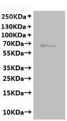 ИФА