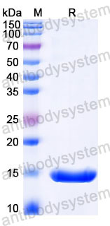 Валидация SDS-PAGE - AntibodySystem RVV25901