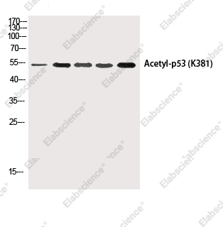 Вестерн-блоттинг, p53 (Acetyl Lys381), клетки HepG2, 293T-UV, Hela, AD293T, Hela-UV