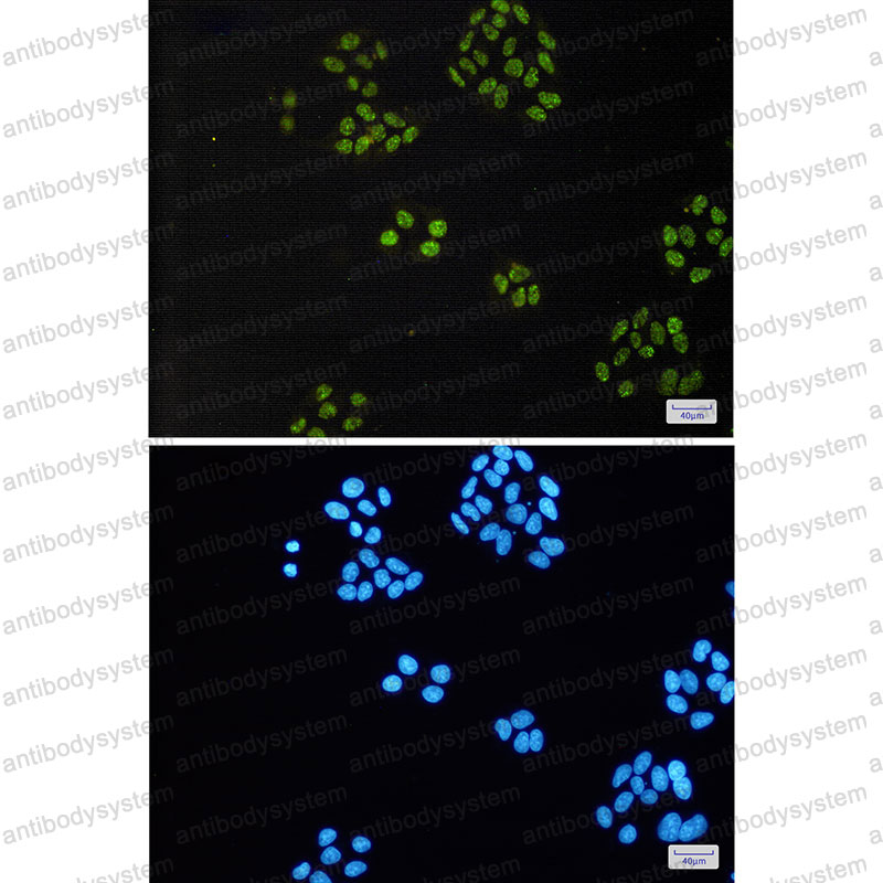 Валидация IF - AntibodySystem RHN77701