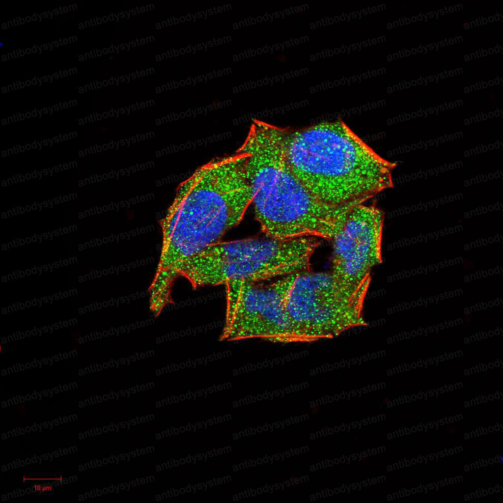 Валидация IF - AntibodySystem RHD03301 (504)