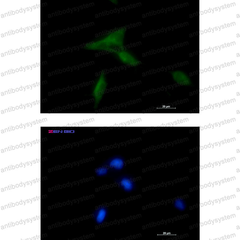 Валидация IF - AntibodySystem RHN73701