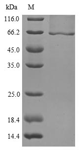 SDS-PAGE