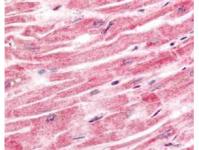 Валидация AssayVector ARM1701(1978)