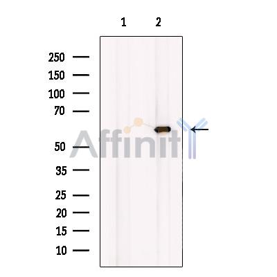 Валидация Affinity DF12033 - 6063