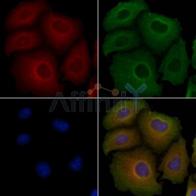 Валидация Affinity DF10148 - 5674