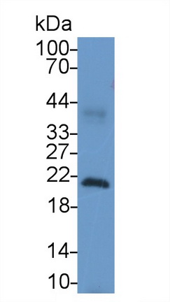 62238