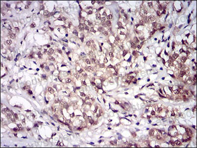 Валидация AntibodySystem RHF48402