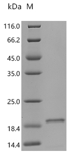 SDS-PAGE