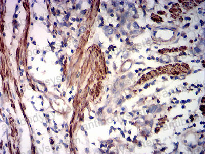 Валидация AntibodySystem RHF52706