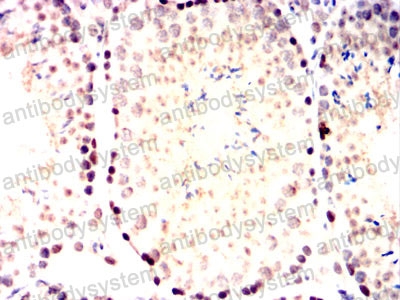 Валидация AntibodySystem RHE73903 (2302)