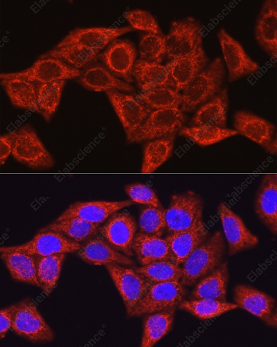 Иммунофлуоресценция, Glutamine Synthetase, клетки HeLa