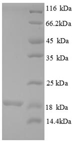 SDS-PAGE