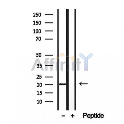 Валидация Affinity DF12252 - 6571