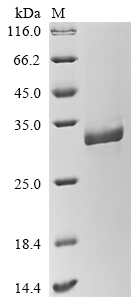 SDS-PAGE