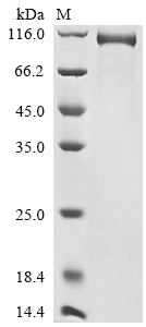 SDS-PAGE