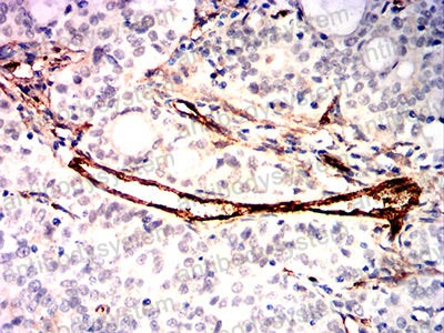Валидация AntibodySystem RHD26503 (1438)