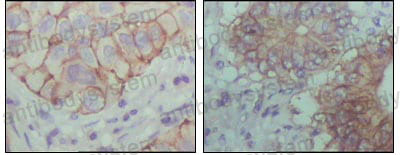 Валидация AntibodySystem RHF05202