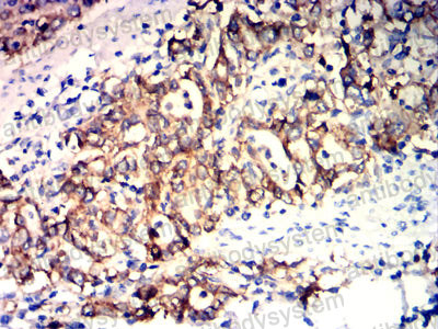Валидация AntibodySystem RHD17407 (1391)
