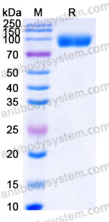 AWC09601, SDS-PAGE