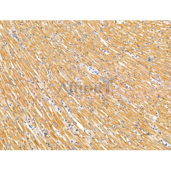 Валидация Affinity DF13487 - 8861