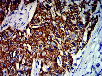 Валидация AntibodySystem RHC99404