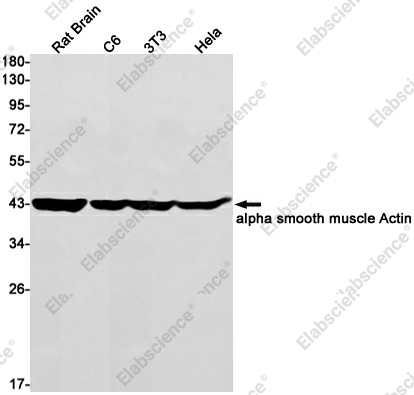 Вестерн-блоттинг, alpha smooth muscle Actin, ткань мозга крысы и клеточные линии