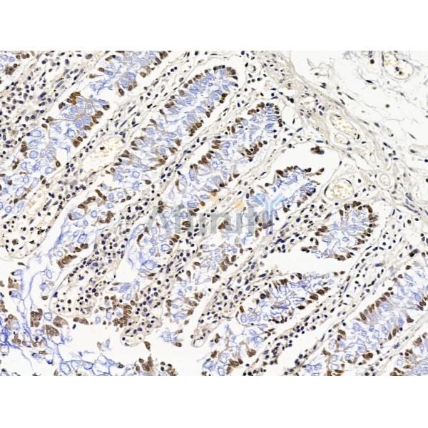 Валидация Affinity DF13539 - 8965