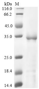 SDS-PAGE