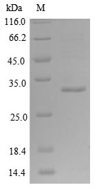 SDS-PAGE