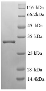 SDS-PAGE