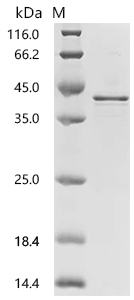 SDS-PAGE