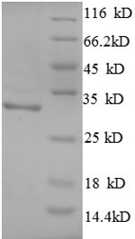 SDS-PAGE