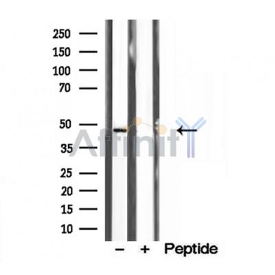 Валидация Affinity DF12187 - 6418
