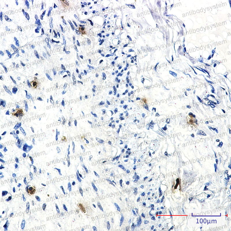 Валидация AntibodySystem RHD60801