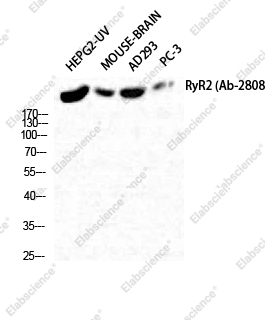 Вестерн-блоттинг, RYR2, клетки HepG2-UV, ткань мозга мыши, клетки AD293T, клетки PC-3