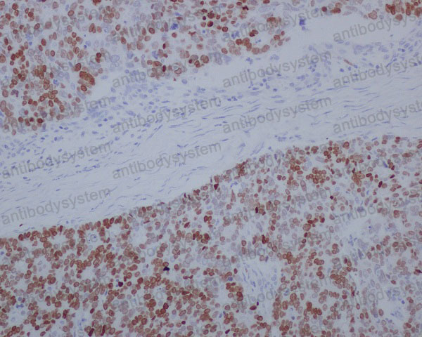 Валидация AntibodySystem RHK53201 (3693)