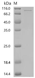 SDS-PAGE