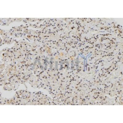 Валидация Affinity DF6612 - 18070